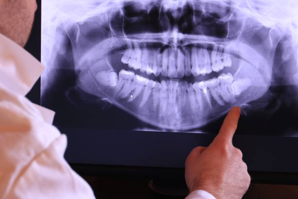 Best Pediatric Emergency Dentist in Fairview, CA